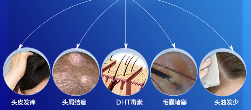 海飞丝控油去屑新升级